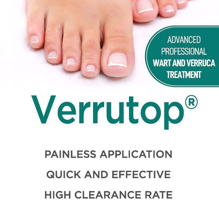 Verrutop - painless verruca treatment