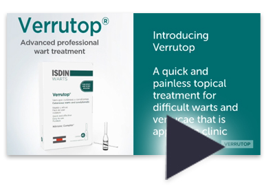 Verrutop Customer Video